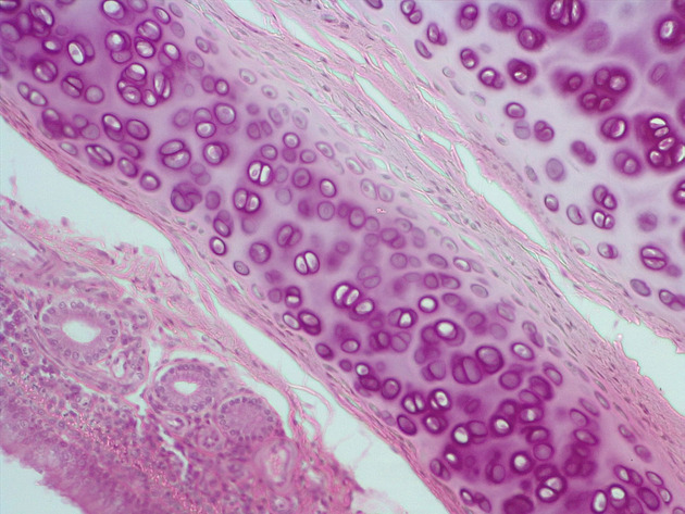 Trachea Slides - Trachea 04 100X